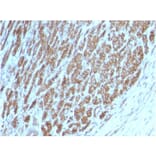 Immunohistochemistry - Anti-beta Catenin Antibody [CTNNB1/2098] - BSA and Azide free (A251471) - Antibodies.com