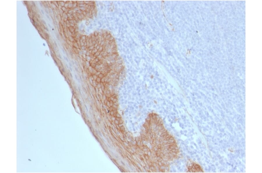 Immunohistochemistry - Anti-beta Catenin Antibody [CTNNB1/2098] - BSA and Azide free (A251471) - Antibodies.com