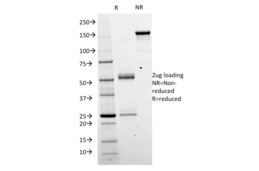 SDS-PAGE - Anti-beta Catenin Antibody [CTNNB1/2098] - BSA and Azide free (A251471) - Antibodies.com