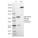 SDS-PAGE - Anti-beta Catenin Antibody [CTNNB1/2098] - BSA and Azide free (A251471) - Antibodies.com
