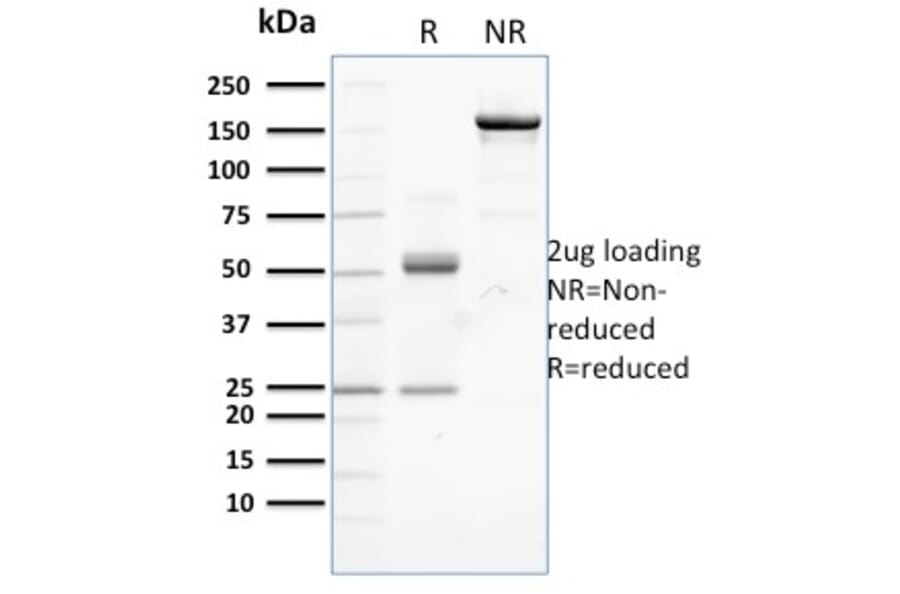 SDS-PAGE - Anti-beta Catenin Antibody [CTNNB1/2099] - BSA and Azide free (A251472) - Antibodies.com