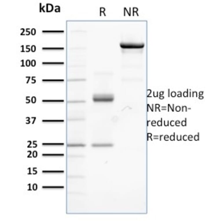 SDS-PAGE - Anti-beta Catenin Antibody [CTNNB1/2099] - BSA and Azide free (A251472) - Antibodies.com