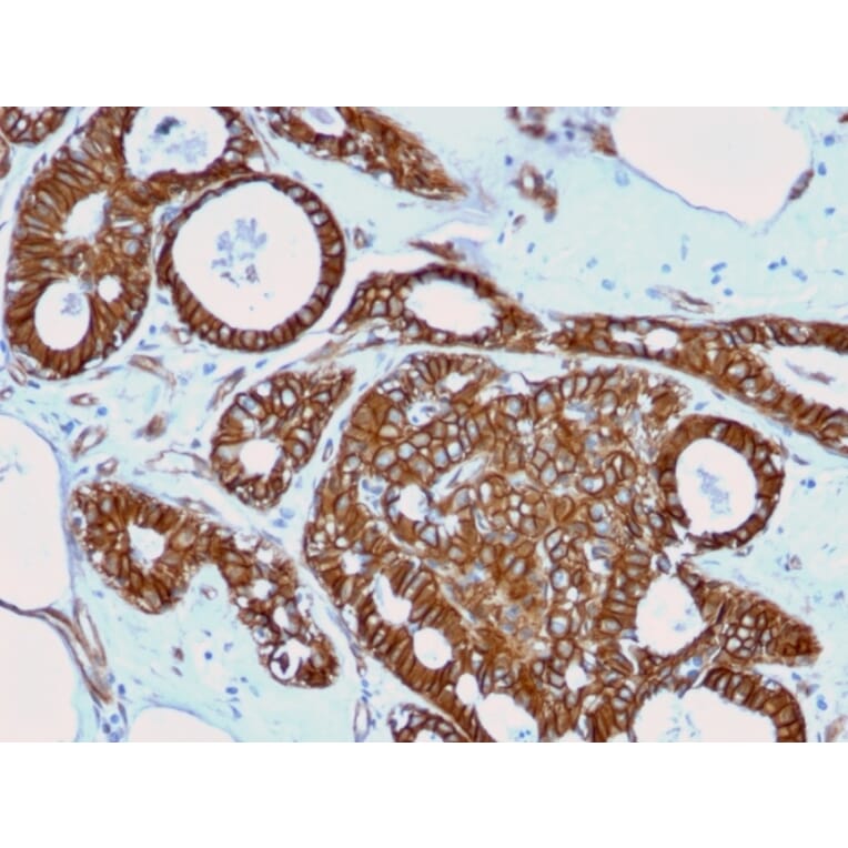 Immunohistochemistry - Anti-beta Catenin Antibody [rCTNNB1/2173] - BSA and Azide free (A251473) - Antibodies.com