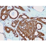 Immunohistochemistry - Anti-beta Catenin Antibody [rCTNNB1/2173] - BSA and Azide free (A251473) - Antibodies.com