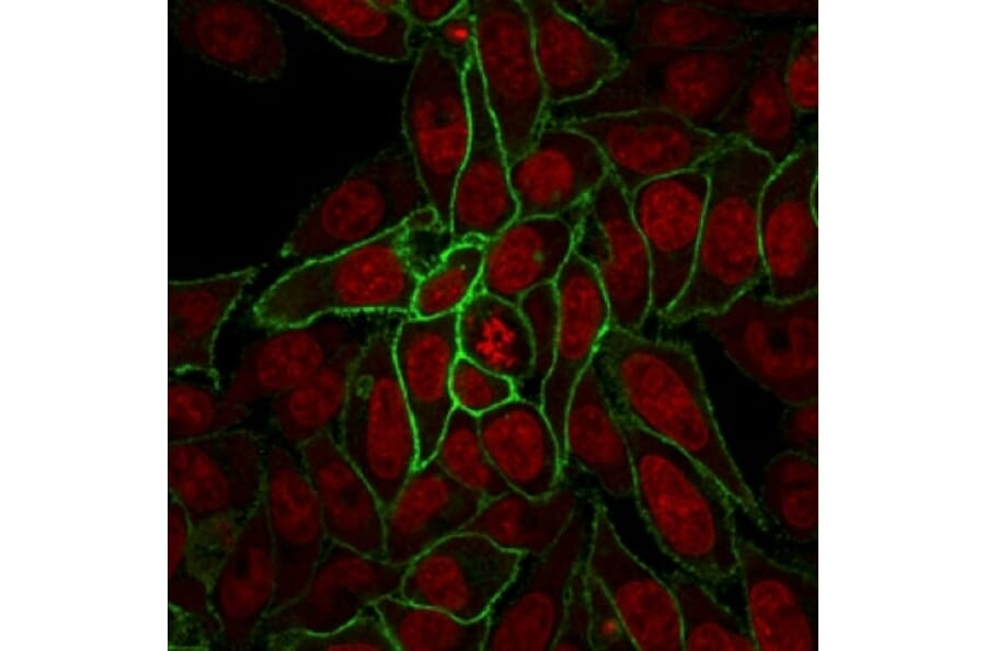 Immunofluorescence - Anti-beta Catenin Antibody [rCTNNB1/2173] - BSA and Azide free (A251473) - Antibodies.com