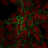 Immunofluorescence - Anti-beta Catenin Antibody [rCTNNB1/2173] - BSA and Azide free (A251473) - Antibodies.com
