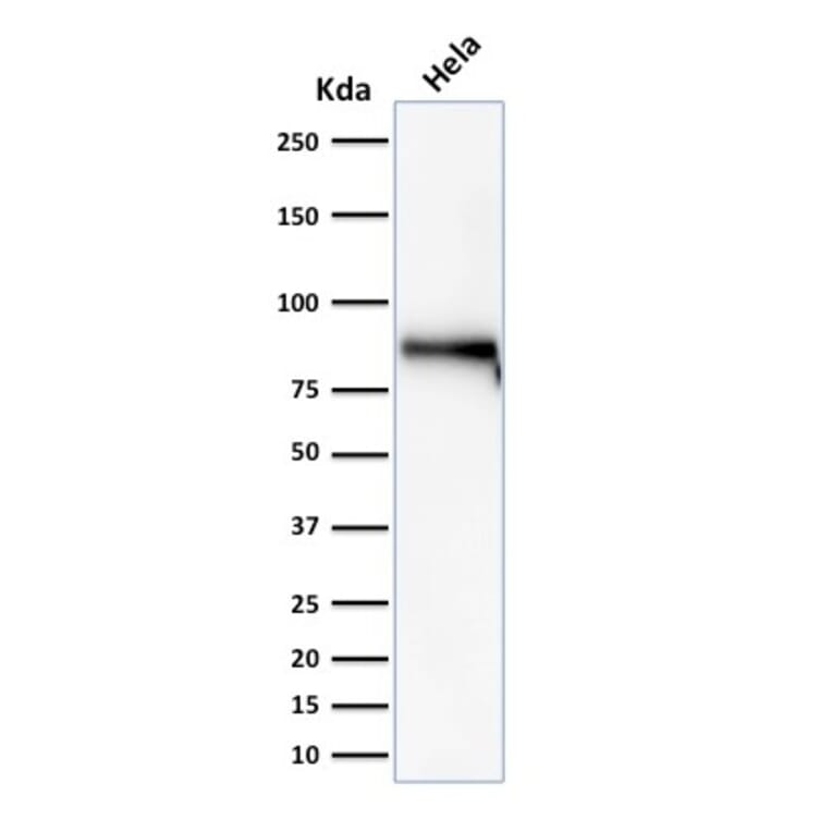 Western Blot - Anti-beta Catenin Antibody [rCTNNB1/2173] - BSA and Azide free (A251473) - Antibodies.com