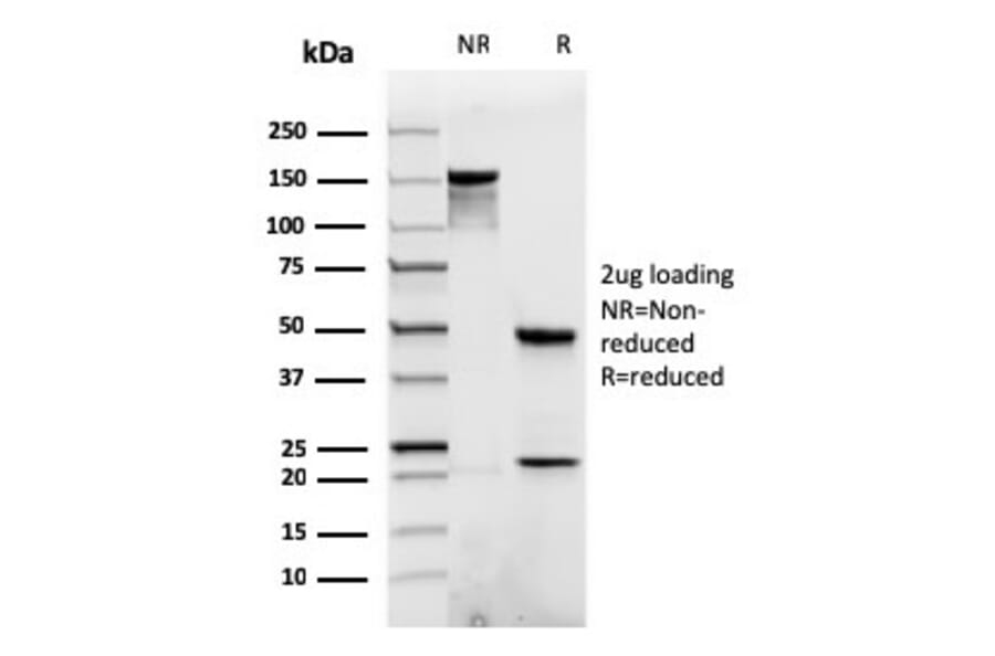 SDS-PAGE - Anti-beta Catenin Antibody [rCTNNB1/1507] - BSA and Azide free (A251474) - Antibodies.com