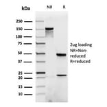 SDS-PAGE - Anti-beta Catenin Antibody [rCTNNB1/1507] - BSA and Azide free (A251474) - Antibodies.com