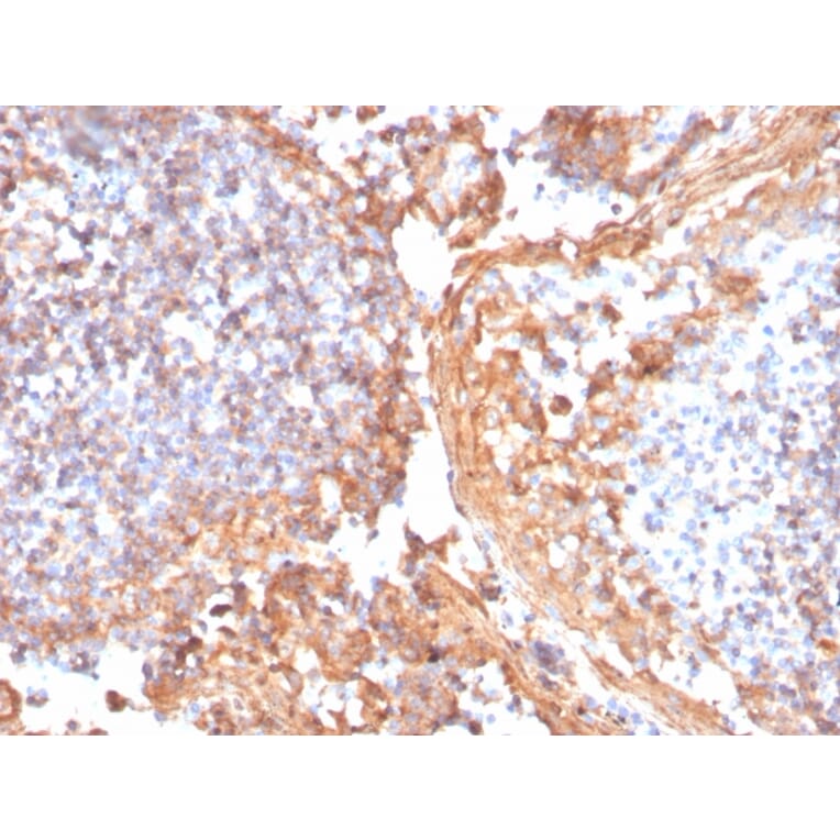 Immunohistochemistry - Anti-beta Catenin Antibody [rCTNNB1/1507] - BSA and Azide free (A251474) - Antibodies.com