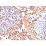 Immunohistochemistry - Anti-beta Catenin Antibody [rCTNNB1/1507] - BSA and Azide free (A251474) - Antibodies.com