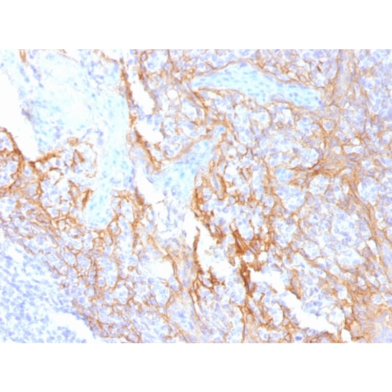 Immunohistochemistry - Anti-beta Catenin Antibody [15B8] - BSA and Azide free (A251476) - Antibodies.com