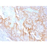Immunohistochemistry - Anti-beta Catenin Antibody [15B8] - BSA and Azide free (A251476) - Antibodies.com