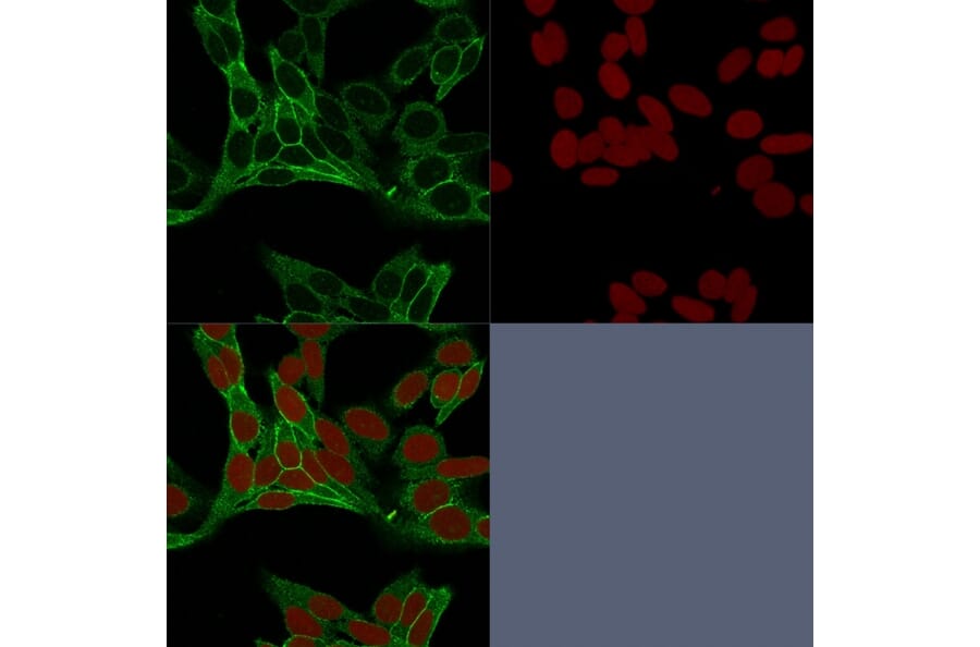 Immunofluorescence - Anti-beta Catenin Antibody [15B8] - BSA and Azide free (A251475) - Antibodies.com