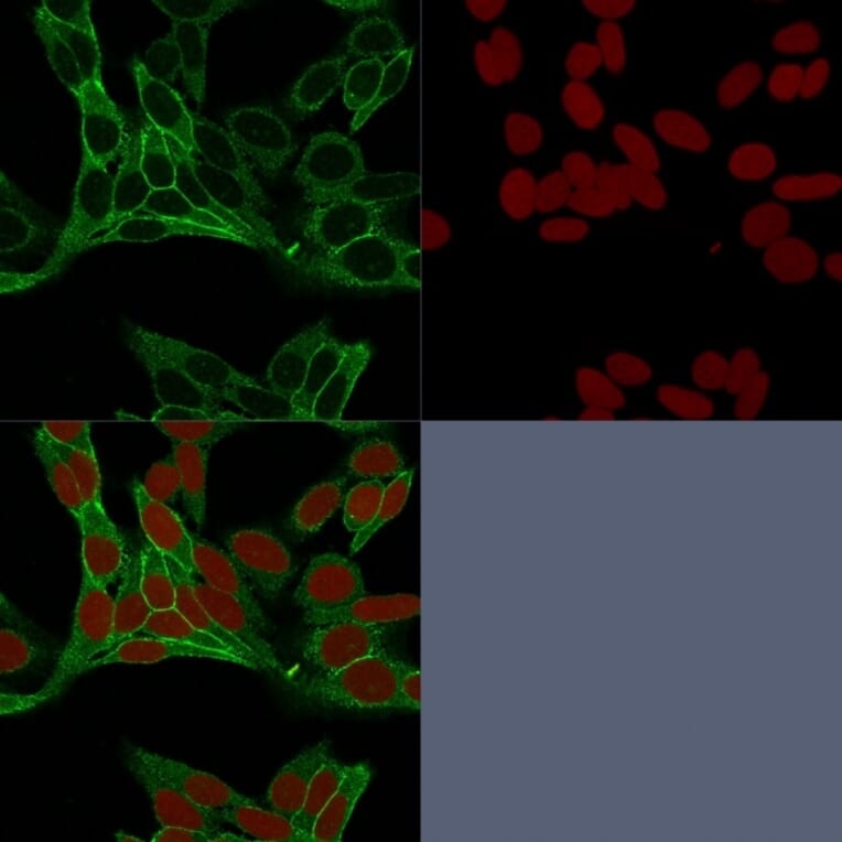 Immunofluorescence - Anti-beta Catenin Antibody [15B8] - BSA and Azide free (A251475) - Antibodies.com