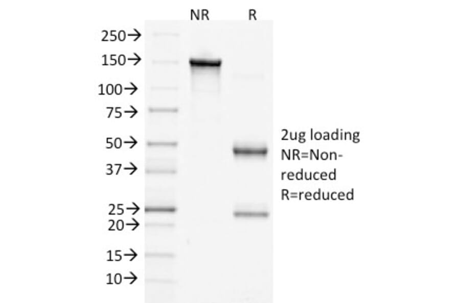 SDS-PAGE - Anti-beta Catenin Antibody [15B8] - BSA and Azide free (A251476) - Antibodies.com
