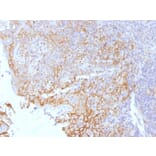 Immunohistochemistry - Anti-beta Catenin Antibody [5H10] - BSA and Azide free (A251477) - Antibodies.com