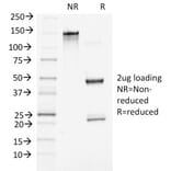 SDS-PAGE - Anti-beta Catenin Antibody [5H10] - BSA and Azide free (A251477) - Antibodies.com
