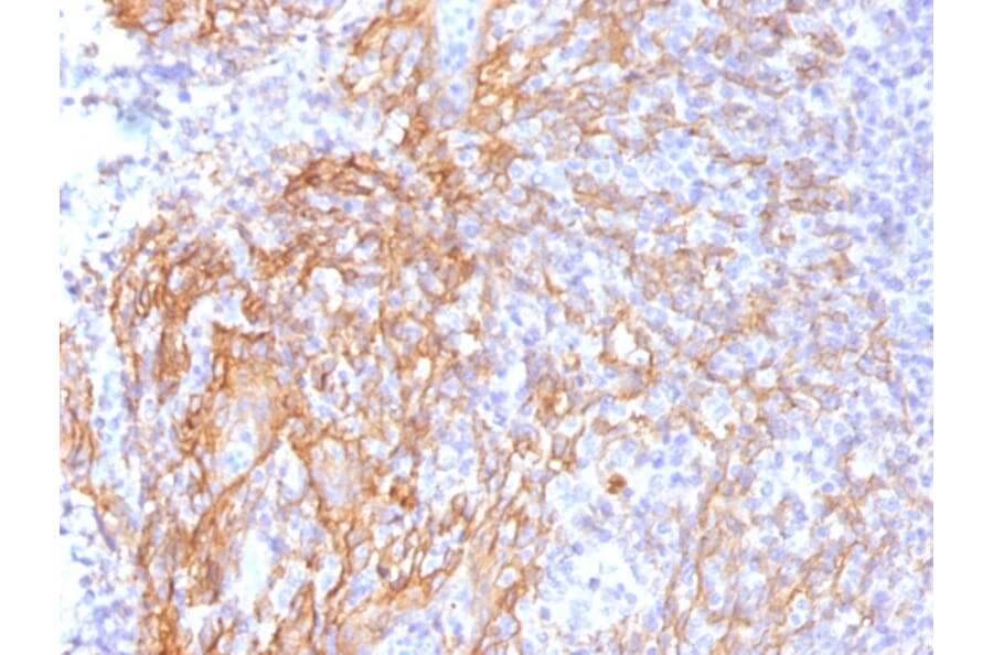 Immunohistochemistry - Anti-beta Catenin Antibody [6F9] - BSA and Azide free (A251478) - Antibodies.com