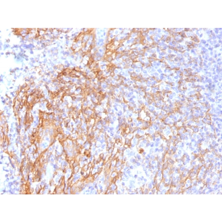 Immunohistochemistry - Anti-beta Catenin Antibody [6F9] - BSA and Azide free (A251478) - Antibodies.com