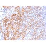 Immunohistochemistry - Anti-beta Catenin Antibody [6F9] - BSA and Azide free (A251478) - Antibodies.com