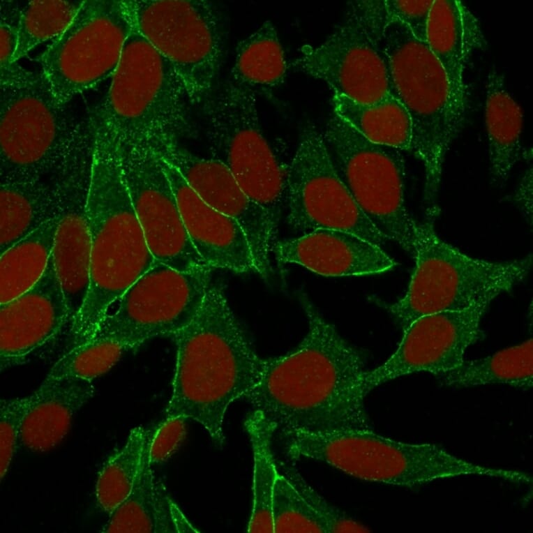 Immunofluorescence - Anti-beta Catenin Antibody [6F9] - BSA and Azide free (A251477) - Antibodies.com