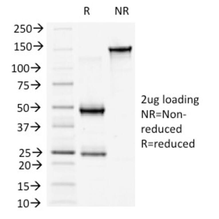 SDS-PAGE - Anti-beta Catenin Antibody [6F9] - BSA and Azide free (A251478) - Antibodies.com