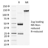 SDS-PAGE - Anti-beta Catenin Antibody [6F9] - BSA and Azide free (A251478) - Antibodies.com