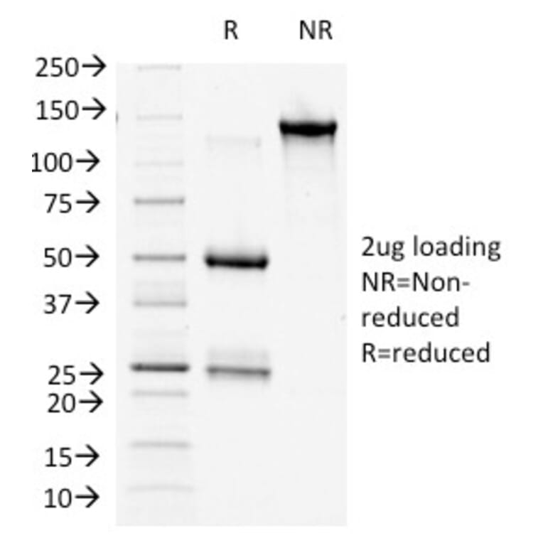 SDS-PAGE - Anti-beta Catenin Antibody [9F2] - BSA and Azide free (A251478) - Antibodies.com