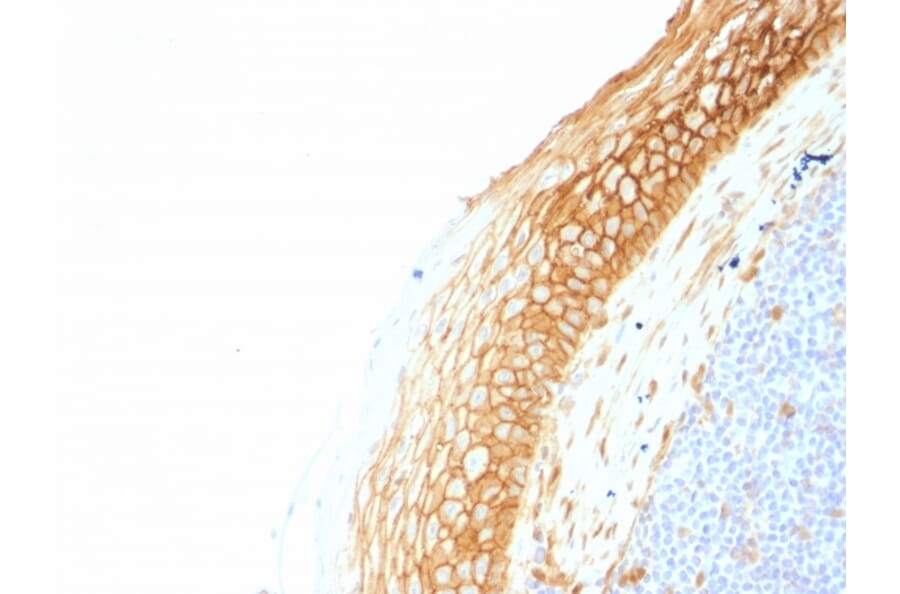Immunohistochemistry - Anti-beta Catenin Antibody [CTNNB1/1507] - BSA and Azide free (A251480) - Antibodies.com