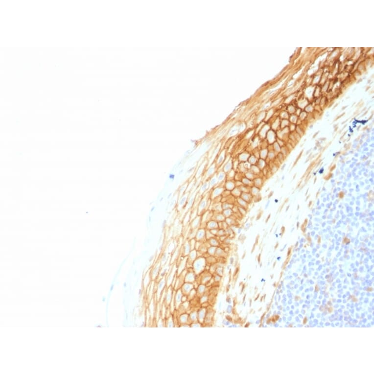 Immunohistochemistry - Anti-beta Catenin Antibody [CTNNB1/1507] - BSA and Azide free (A251480) - Antibodies.com