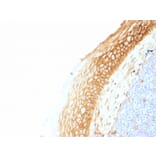 Immunohistochemistry - Anti-beta Catenin Antibody [CTNNB1/1507] - BSA and Azide free (A251480) - Antibodies.com