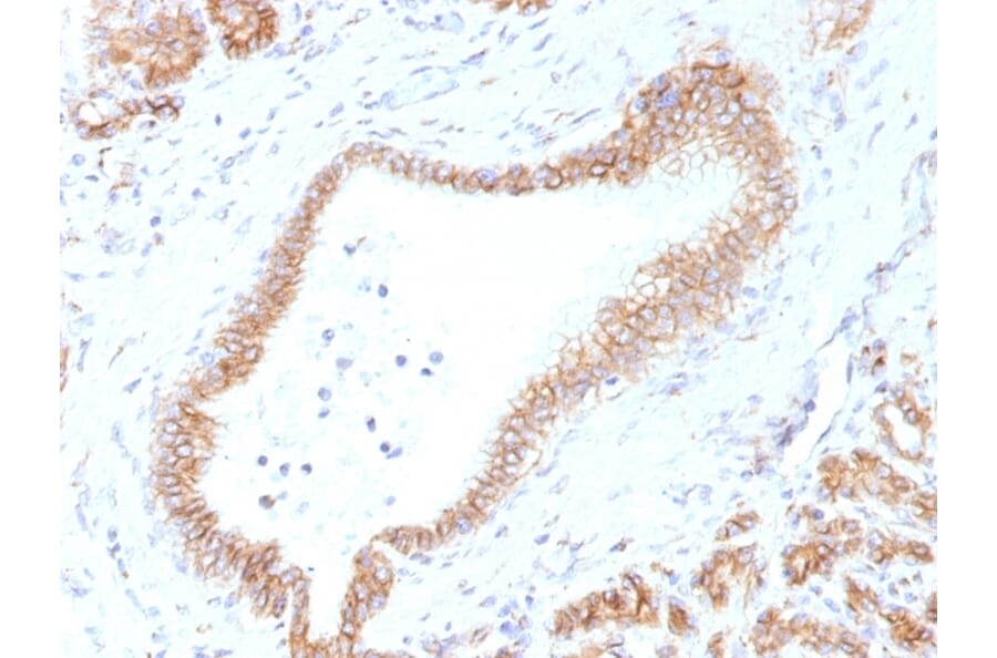 Immunohistochemistry - Anti-beta Catenin Antibody [CTNNB1/1507] - BSA and Azide free (A251479) - Antibodies.com