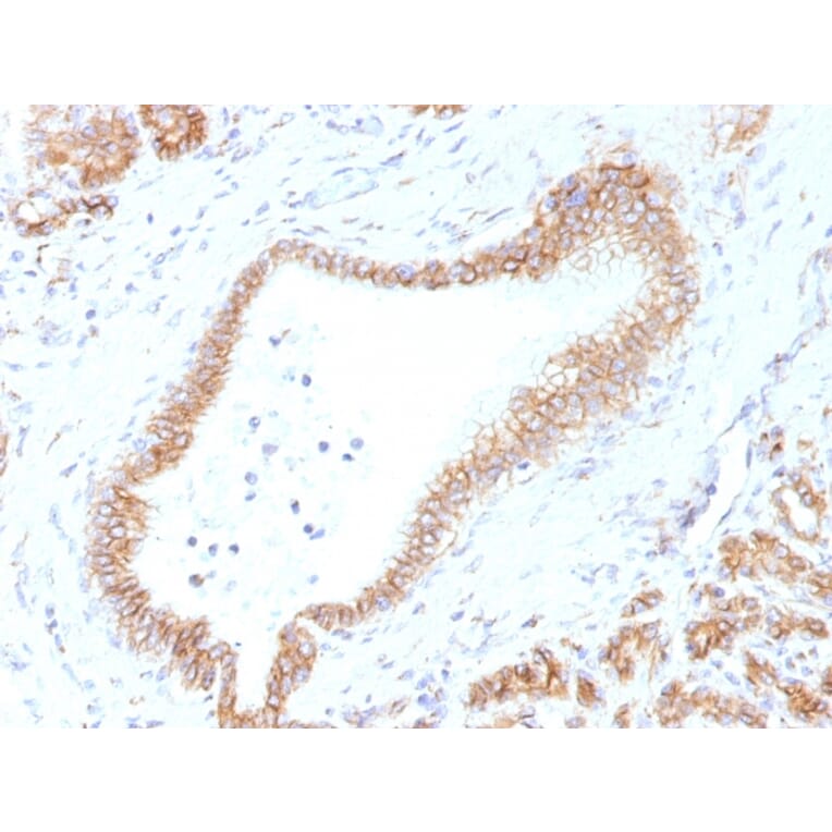 Immunohistochemistry - Anti-beta Catenin Antibody [CTNNB1/1507] - BSA and Azide free (A251479) - Antibodies.com