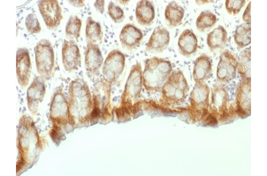 Immunohistochemistry - Anti-beta Catenin Antibody [CTNNB1/1507] - BSA and Azide free (A251480) - Antibodies.com