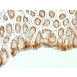 Immunohistochemistry - Anti-beta Catenin Antibody [CTNNB1/1507] - BSA and Azide free (A251480) - Antibodies.com