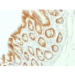 Immunohistochemistry - Anti-beta Catenin Antibody [CTNNB1/1507] - BSA and Azide free (A251480) - Antibodies.com