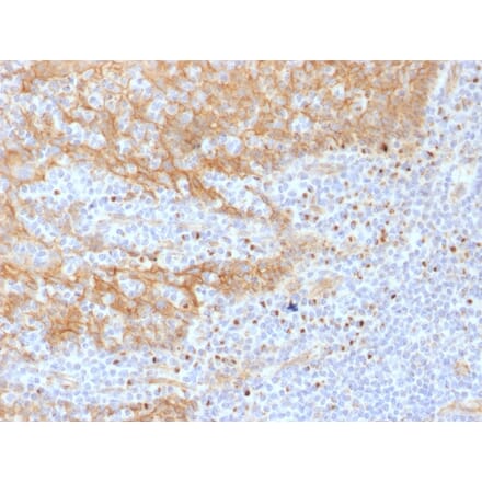 Immunohistochemistry - Anti-beta Catenin Antibody [CTNNB1/1508] - BSA and Azide free (A251481) - Antibodies.com