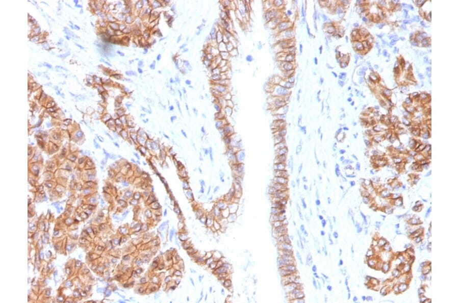 Immunohistochemistry - Anti-beta Catenin Antibody [CTNNB1/1508] - BSA and Azide free (A251480) - Antibodies.com