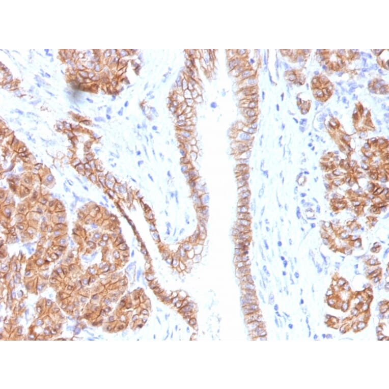 Immunohistochemistry - Anti-beta Catenin Antibody [CTNNB1/1508] - BSA and Azide free (A251480) - Antibodies.com