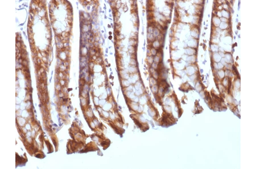 Immunohistochemistry - Anti-beta Catenin Antibody [CTNNB1/1508] - BSA and Azide free (A251481) - Antibodies.com