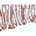 Immunohistochemistry - Anti-beta Catenin Antibody [CTNNB1/1508] - BSA and Azide free (A251481) - Antibodies.com