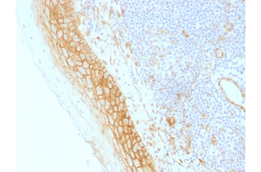 Immunohistochemistry - Anti-beta Catenin Antibody [CTNNB1/1509] - BSA and Azide free (A251482) - Antibodies.com