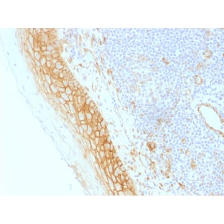 Immunohistochemistry - Anti-beta Catenin Antibody [CTNNB1/1509] - BSA and Azide free (A251482) - Antibodies.com