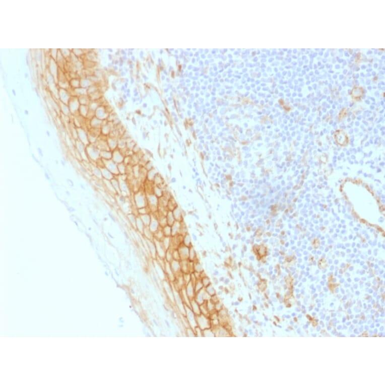 Immunohistochemistry - Anti-beta Catenin Antibody [CTNNB1/1509] - BSA and Azide free (A251482) - Antibodies.com