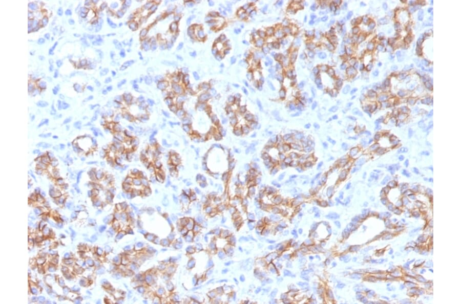 Immunohistochemistry - Anti-beta Catenin Antibody [CTNNB1/1509] - BSA and Azide free (A251481) - Antibodies.com