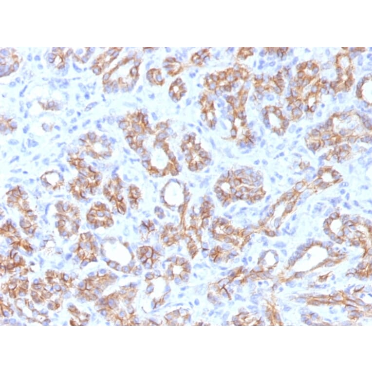 Immunohistochemistry - Anti-beta Catenin Antibody [CTNNB1/1509] - BSA and Azide free (A251481) - Antibodies.com