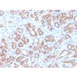Immunohistochemistry - Anti-beta Catenin Antibody [CTNNB1/1509] - BSA and Azide free (A251481) - Antibodies.com