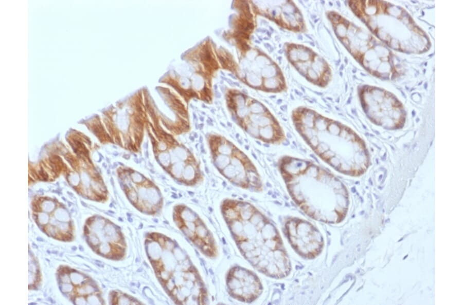 Immunohistochemistry - Anti-beta Catenin Antibody [CTNNB1/1509] - BSA and Azide free (A251482) - Antibodies.com