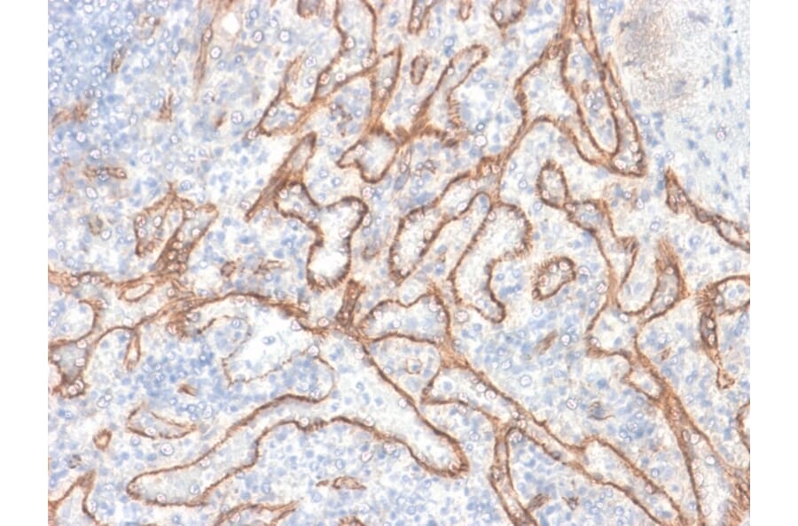 Immunohistochemistry - Anti-beta Catenin Antibody [CTNNB1/2030R] - BSA and Azide free (A251483) - Antibodies.com